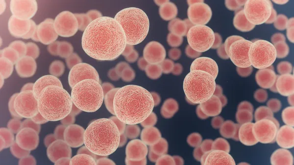 Cancer cells under a microscope